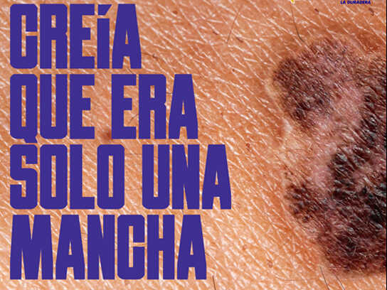 From a Conventional Wall Stain to a Skin Cancer