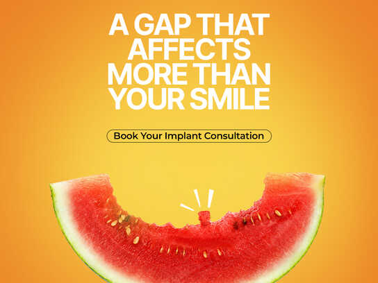 Dental Implants