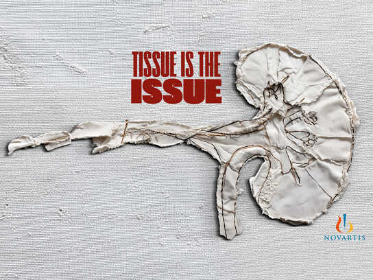 TISSUE IS THE ISSUE | NOVARTIS EVENT