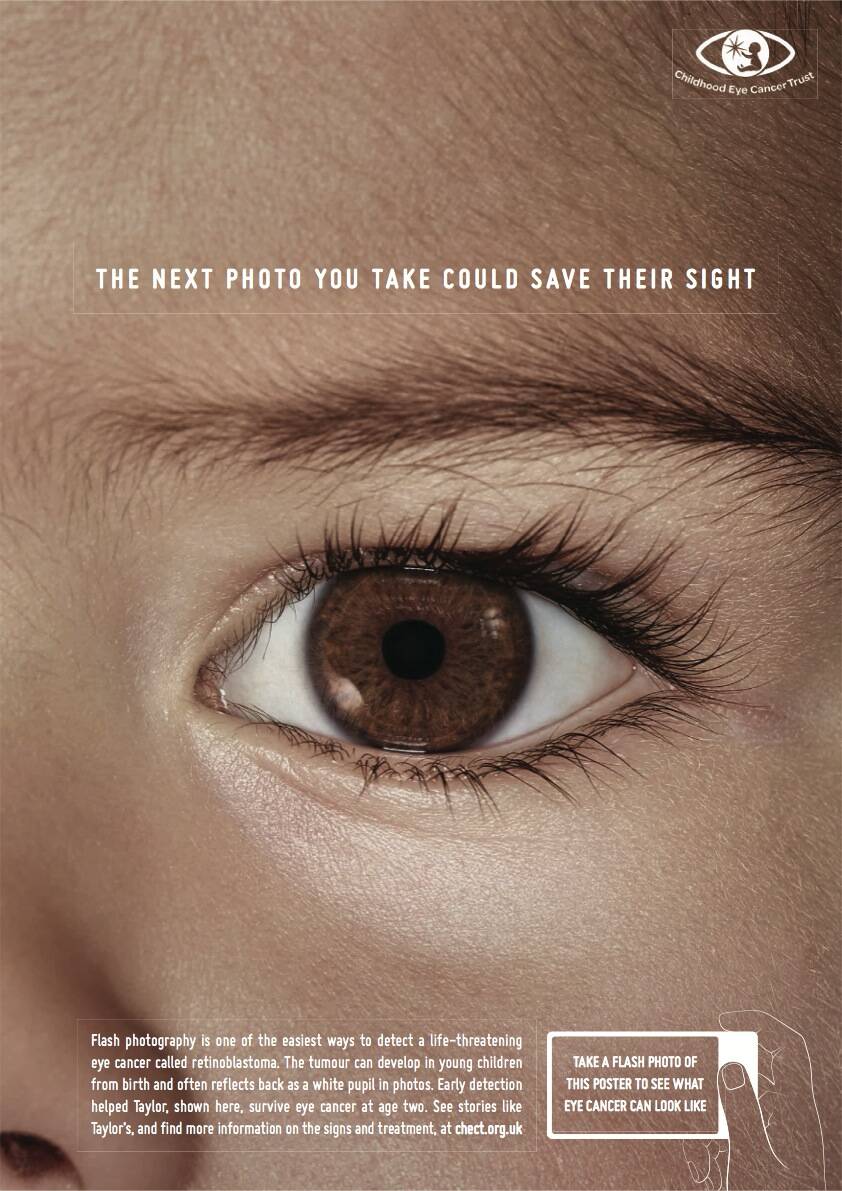 Childhood Eye Cancer Trust Eye Detect Eye Cancer • Ads Of The World