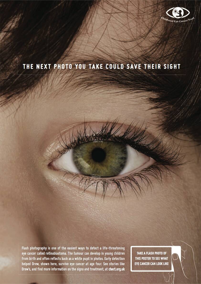 Childhood Eye Cancer Trust Eye Detect Eye Cancer • Ads Of The World