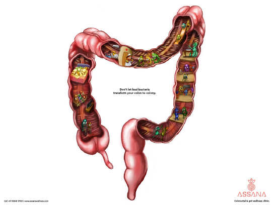 Don’t let bad bacteria transform your colon into a colony.