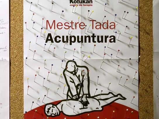 Acupuncture