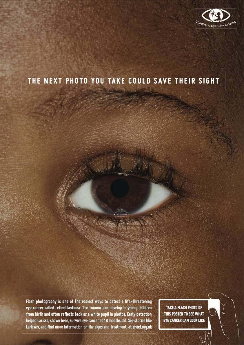 Childhood Eye Cancer Trust Eye Detect Eye Cancer • Ads Of The World