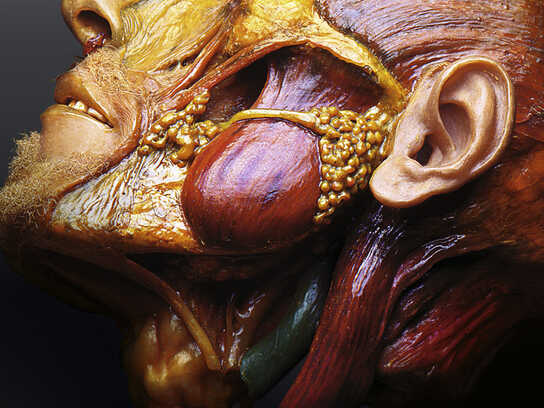 Organ donation, Brain